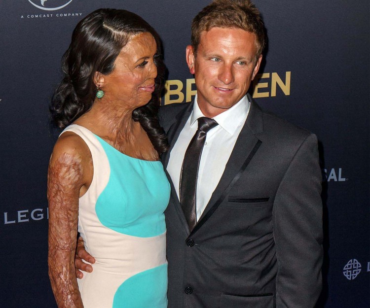 turia pitt and michael hoskins love story